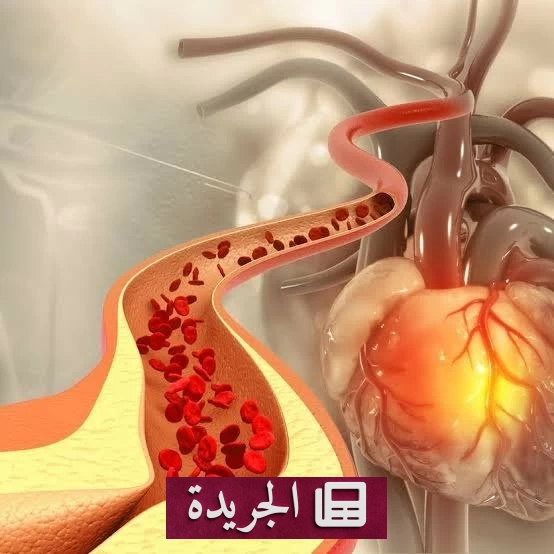 علاج جيني ثوري يخفض الكوليسترول 50% لعام كامل - آخر الأخبار - الجريدة
