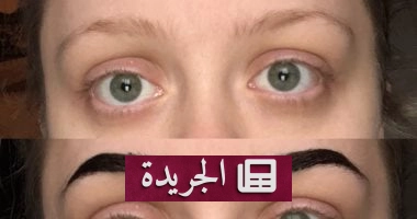 "علامة الملكة آن": كيف يكشف ترقق الحواجب عن خطر صامت على صحتك