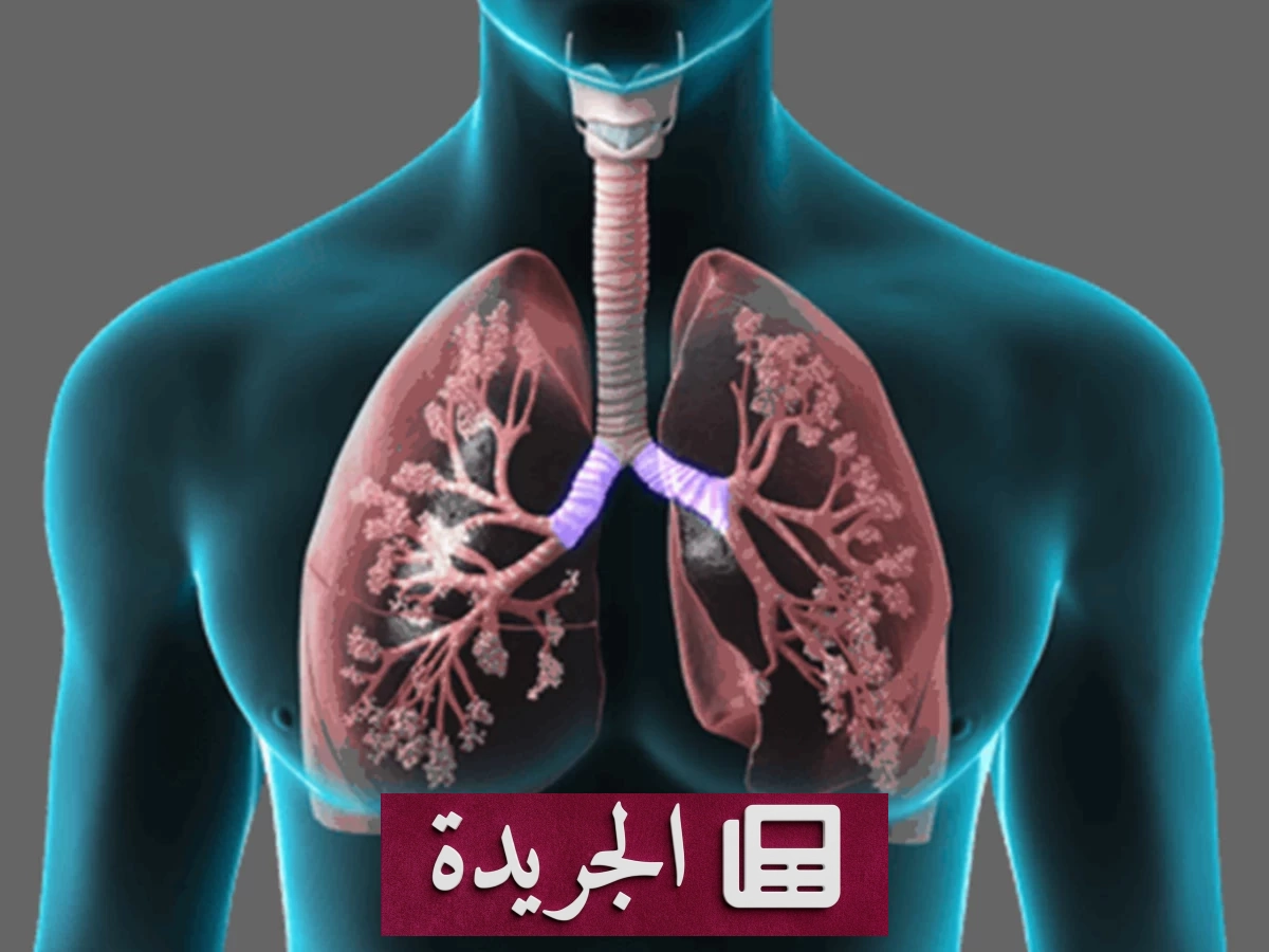 اكتشاف طبي يعيد الأمل في علاج متلازمة الضائقة التنفسية الحادة - آخر الأخبار - الجريدة