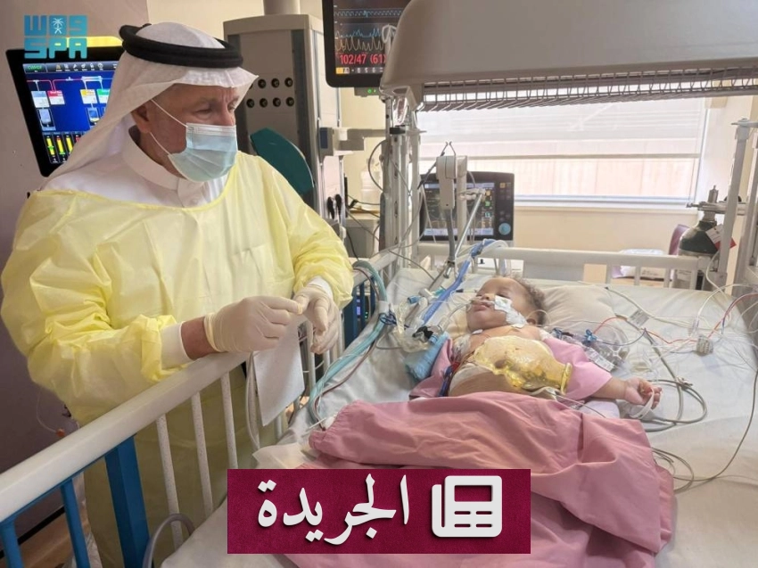 الدكتور عبدالله بن عبدالعزيز يبرز دور الفريق الطبي السعودي في علاج التوائم الملتصقة - أخبار أونلاين