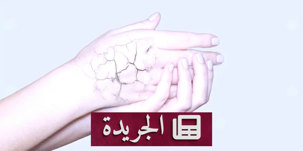 الجفاف.. عدو خفي يرفع سكر الدم ويهدد مرضى السكري - أخبار أونلاين