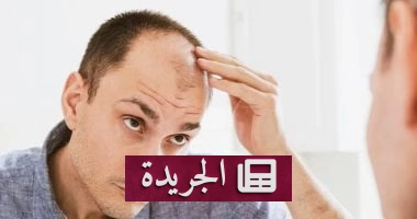 الجهاز الهضمي سر تساقط الشعر: دراسة تكشف عن الرابط المخيف بين الأمعاء والصلع