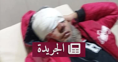 الكلاب الضالة في بورسعيد: المأساة التي تكرر نفسها.. ما وراء الهجوم على المسن إبراهيم محروس؟ - أخبار أونلاين