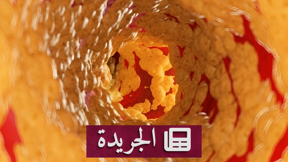 الكوليسترول عدو خفي يتحول مع العمر إلى قاتل صامت - آخر الأخبار - الجريدة