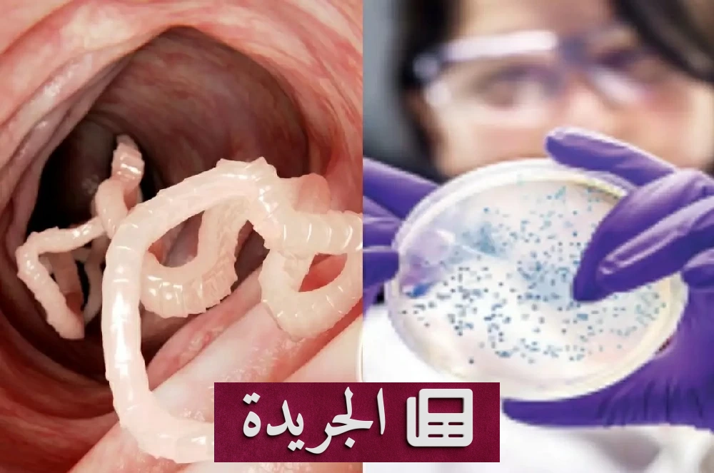 «السيكلوسبورا» يهاجم الولايات المتحدة ويصيب الآلاف عبر الغذاء الملوث - آخر الأخبار - الجريدة