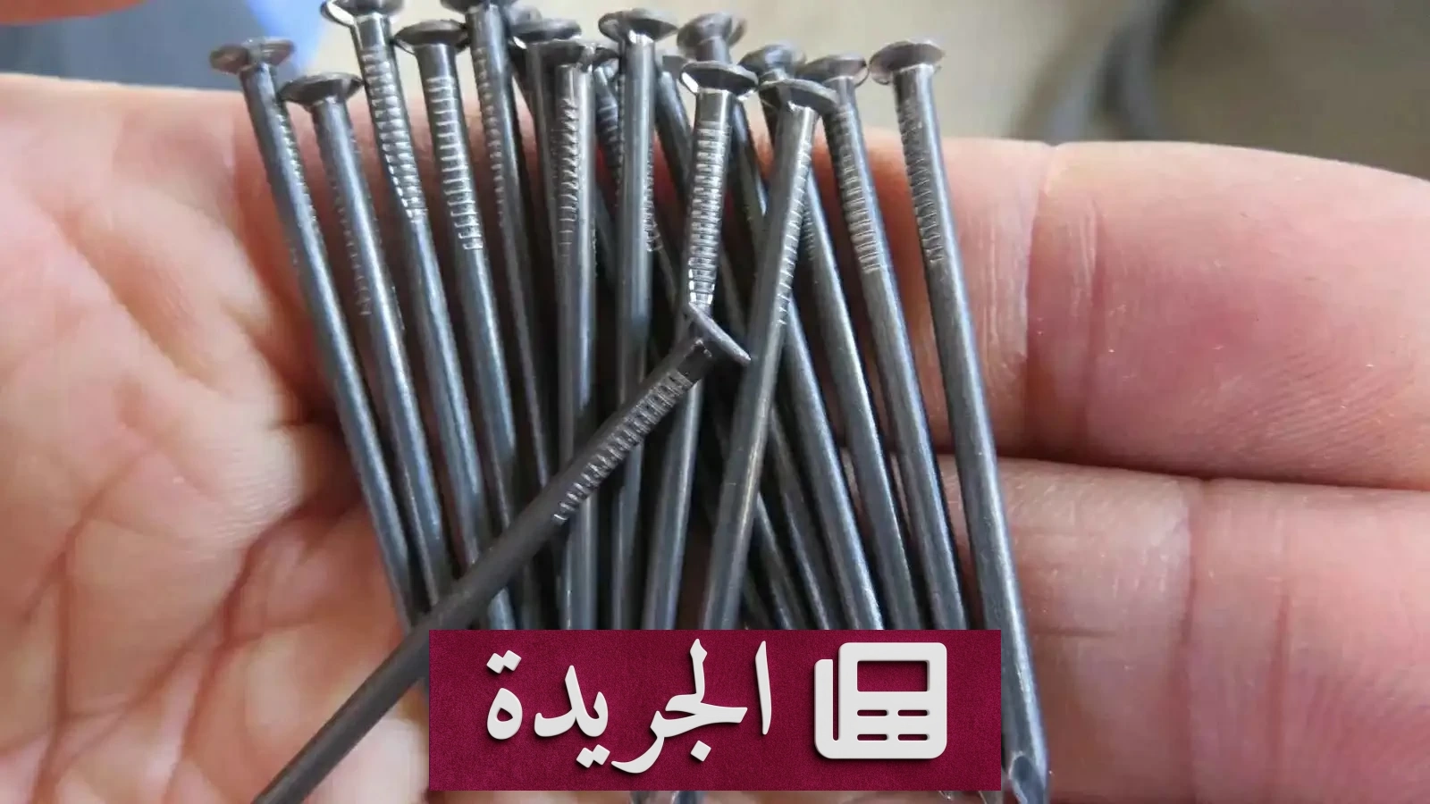 إنجاز طبي غير مسبوق في مصر باستخراج مائة مسمار من معدة مريض - آخر أخبار الجريدة