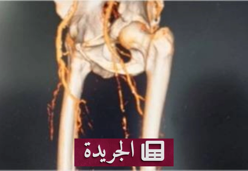 اشترك الآن في النشرة الإخبارية اليومية عبر بريدك الإلكتروني - آخر أخبار الجريدة