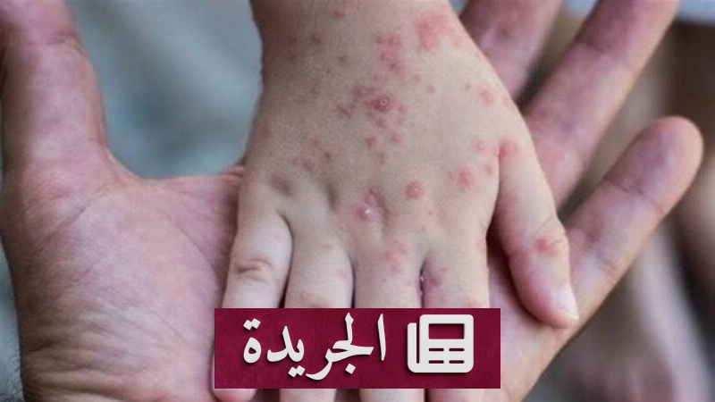 اشترك الآن في النشرة الإخبارية اليومية عبر بريدك الإلكتروني - آخر الأخبار - الجريدة