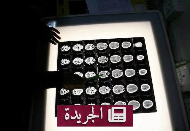 أزمة أدوية السرطان في الهند تتفاقم بسبب ارتفاع أسعار البلاتين - آخر الأخبار - الجريدة