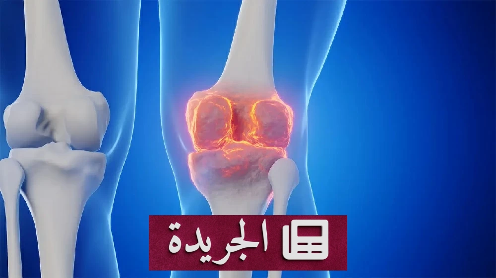 دواء السكري يتحول إلى درع لحماية مفاصل الركبة والورك من الخشونة - آخر الأخبار - الجريدة