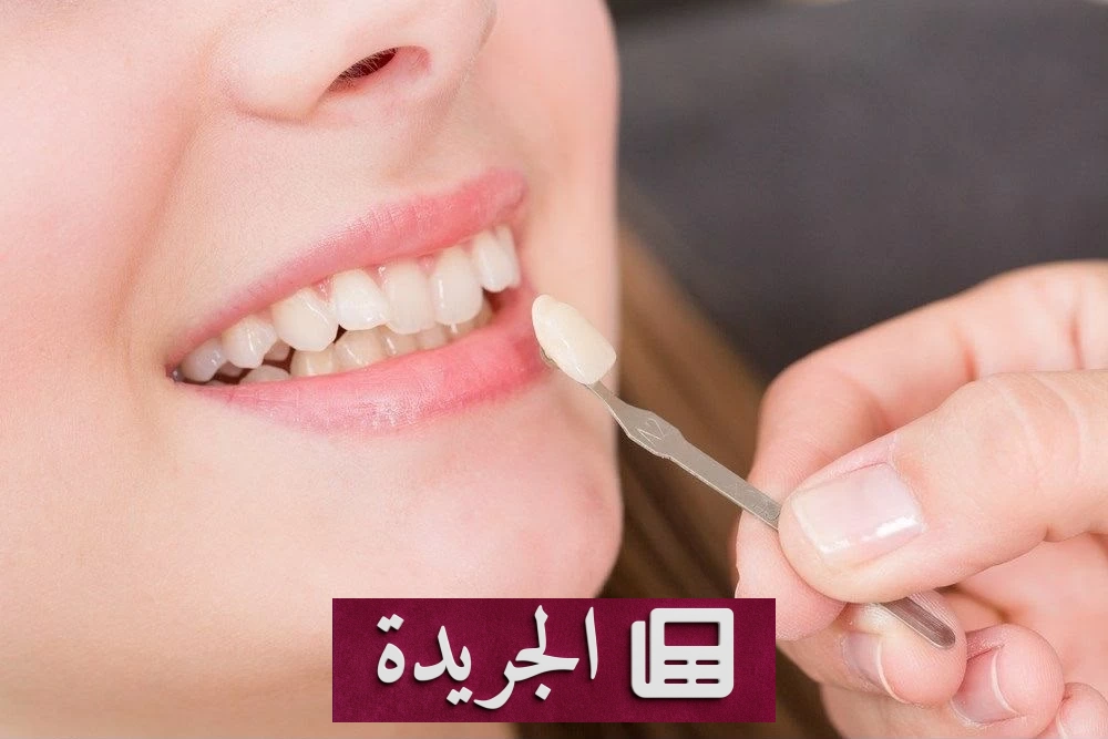 فيتير الأسنان.. جمال الابتسامة ومخاطر لا تُستهان بها - آخر الأخبار - الجريدة