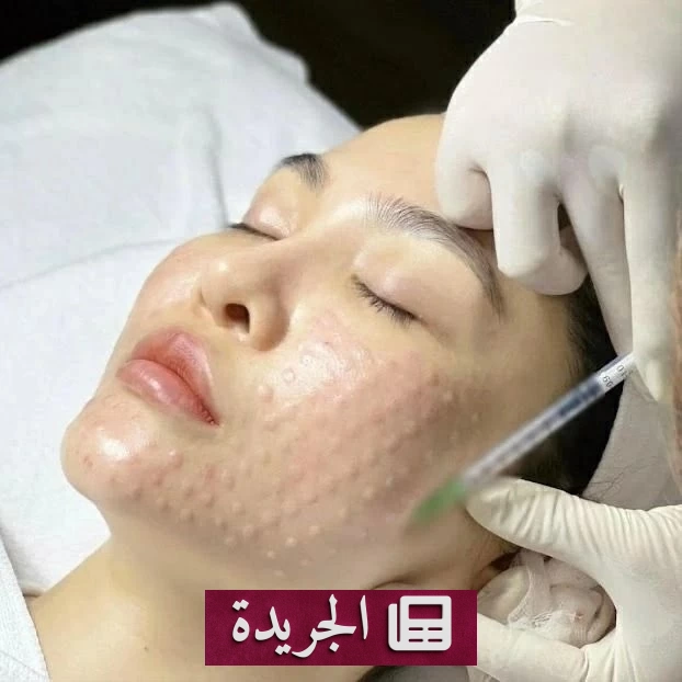 حقن الإكسوزوم للبشرة بين الوعود العلمية والتحذيرات الطبية - آخر الأخبار - الجريدة