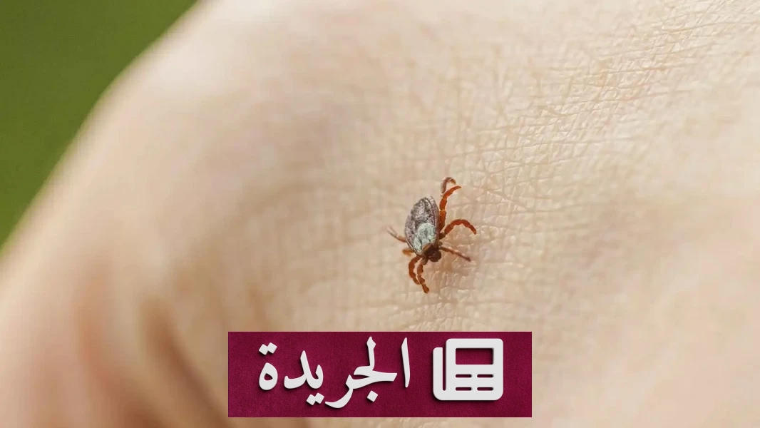 حشرة القراد تقضي على رجل في تركيا بسبب خطأ قاتل - آخر الأخبار - الجريدة