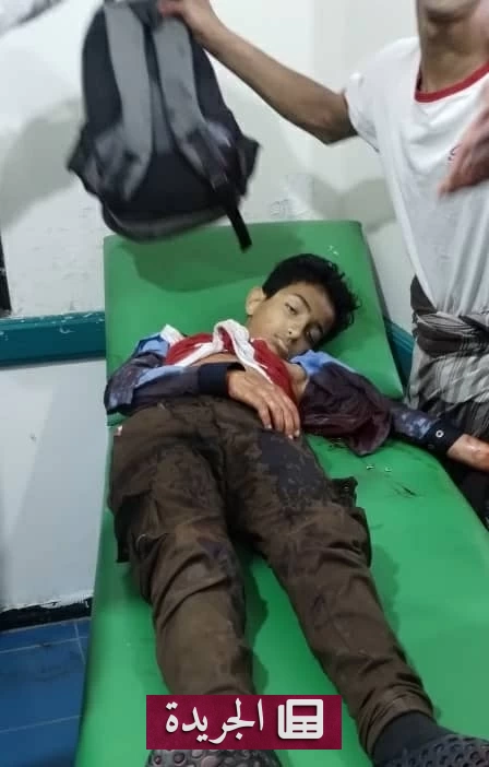 قناص حوثي يرتكب جريمة حرب باستهداف طفل في تعز أمام شقيقته - أخبار أونلاين