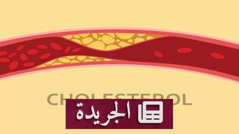 **مخاطر الكوليسترول قبل الحمل: كيف يهدد ارتفاعه حياة الأم على المدى الطويل؟** - أخبار أونلاين