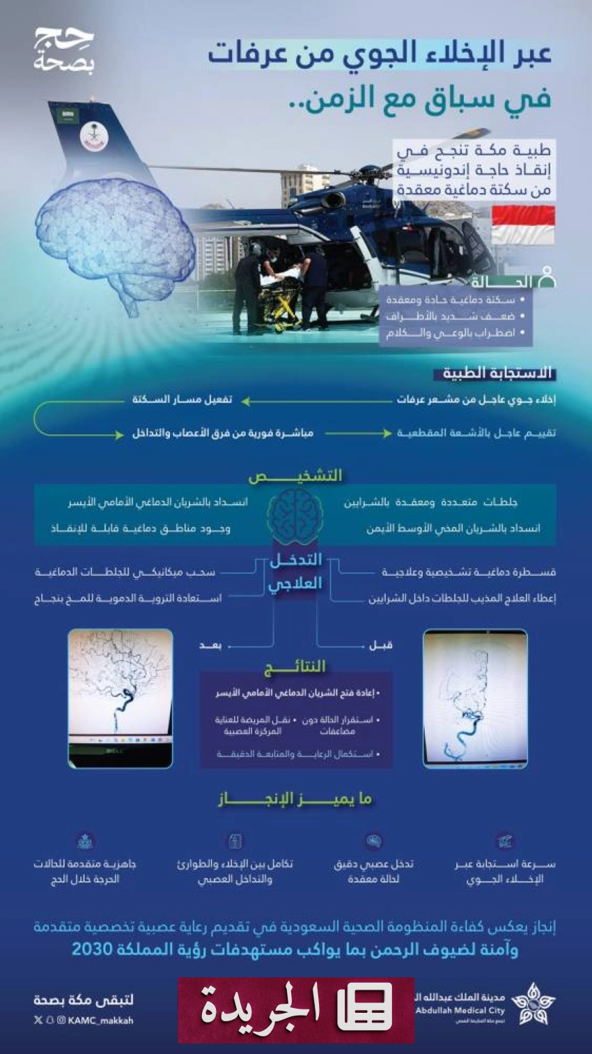 مركز طبي ينقذ حاجّة إندونيسية من سكتة دماغية حادة في عرفات - آخر الأخبار - الجريدة