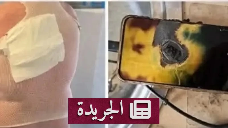 نار الهاتف المحمول تحرق شاباً أثناء نومه بسبب خطأ فادح - آخر الأخبار - الجريدة