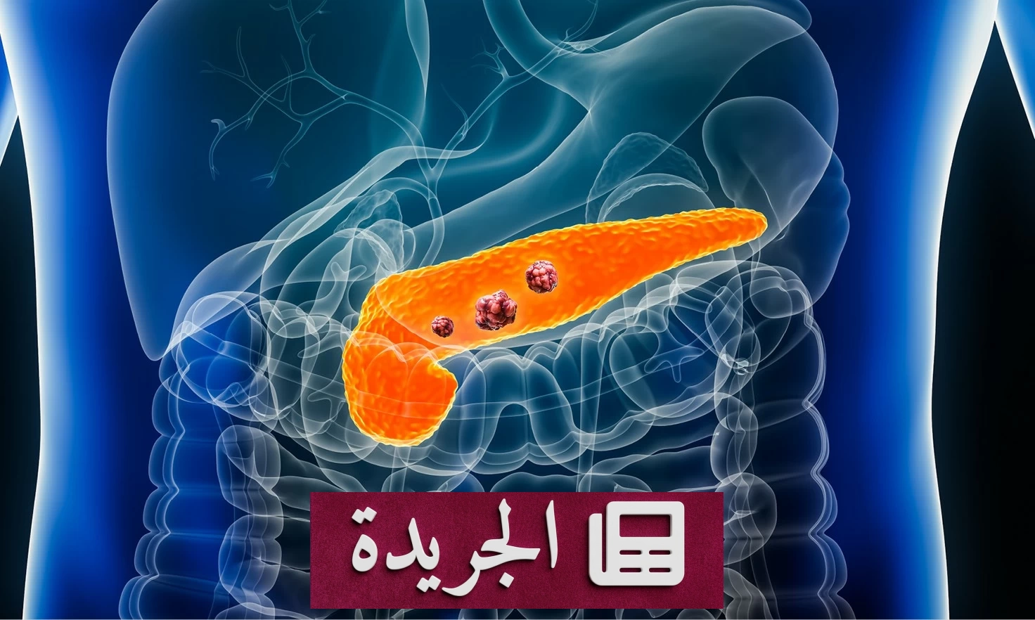 سرطان البنكرياس.. «القاتل الصامت» الذي يخشى الأطباء مواجهته - أخبار أونلاين