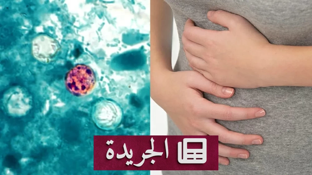 تفشي مرض السيكلوسبورا في الولايات المتحدة.. 1645 إصابة و5100 حالة قيد التحقيق - آخر أخبار الجريدة